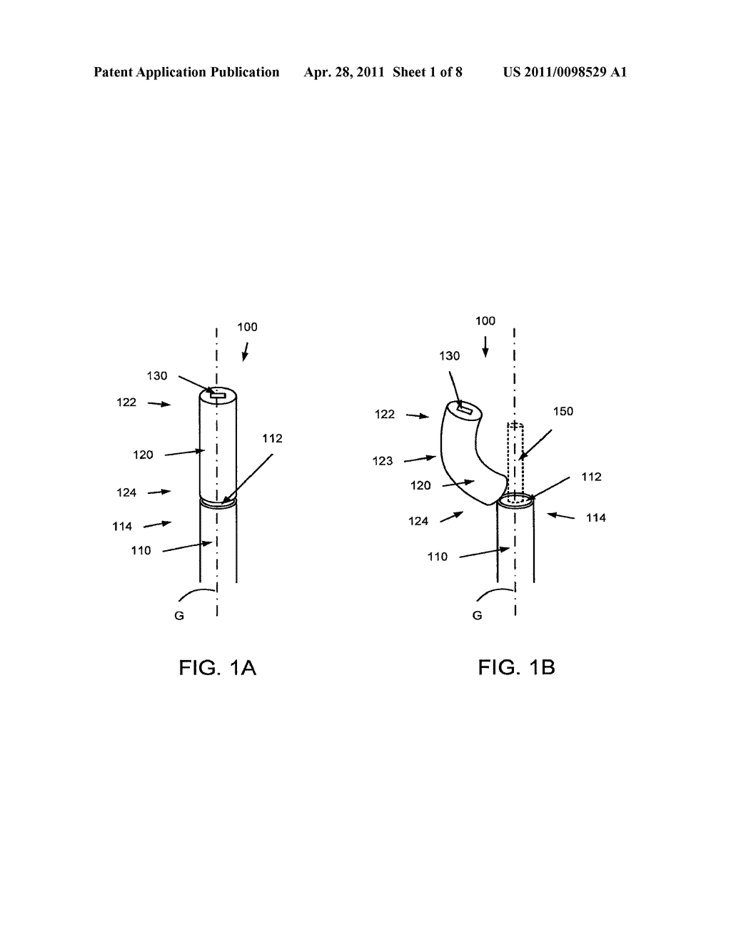 Method and Apparatus Related to a Flexible Assembly at a Distal End Portion of a Medical Device - diagram, schematic, and image 02