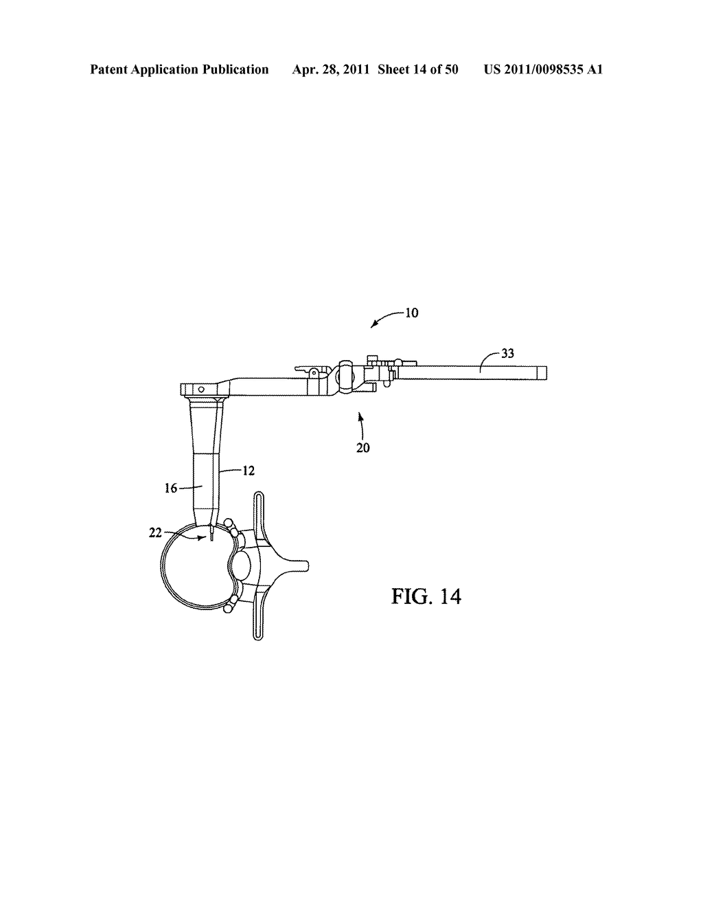 SURGICAL ACCESS SYSTEM AND RELATED METHODS - diagram, schematic, and image 15