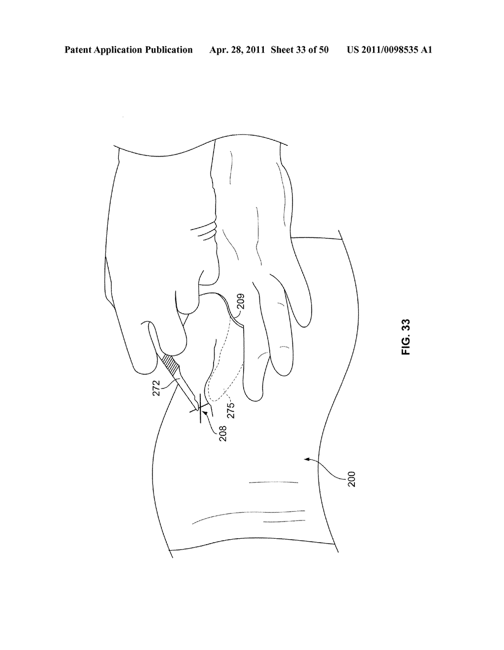 SURGICAL ACCESS SYSTEM AND RELATED METHODS - diagram, schematic, and image 34