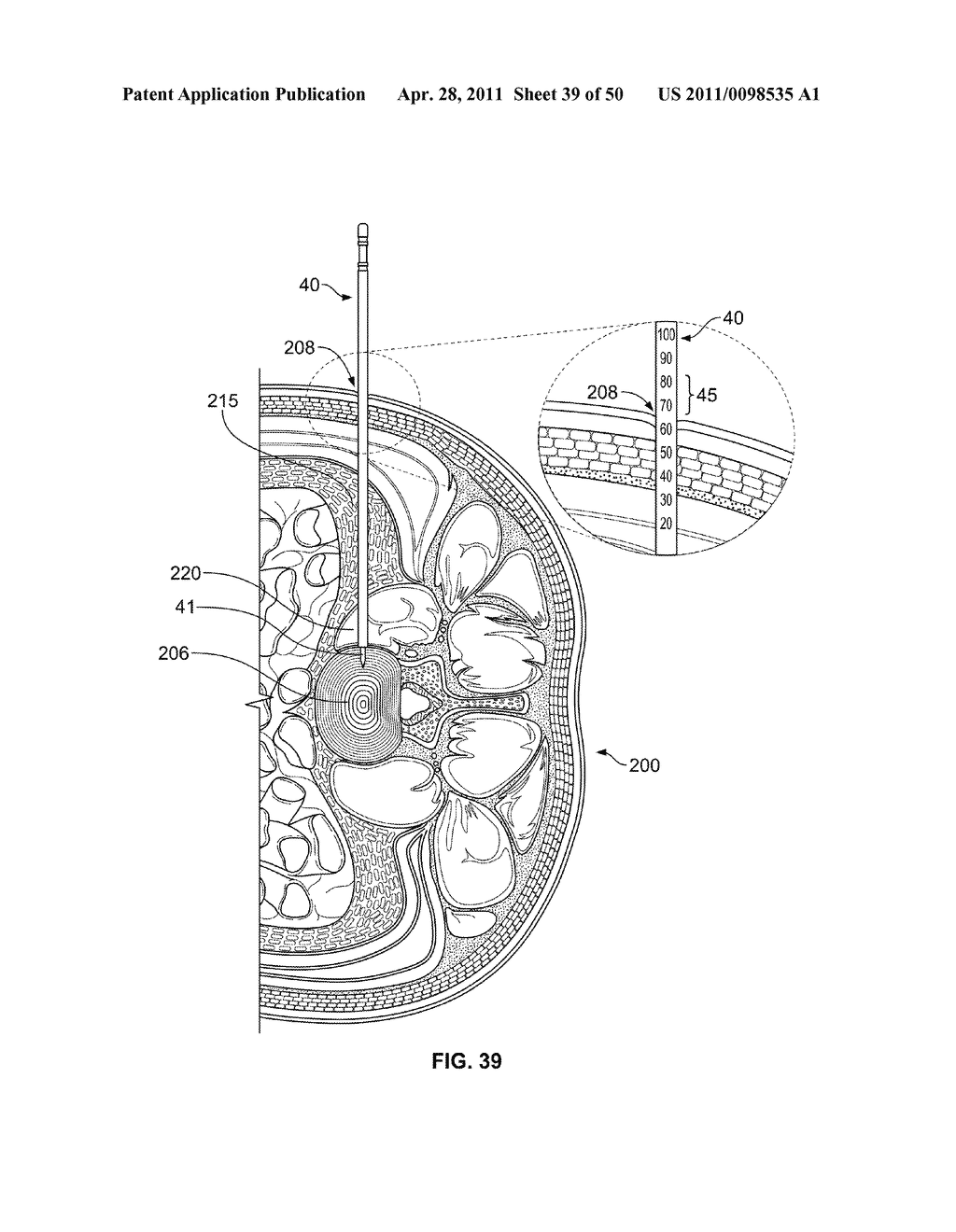 SURGICAL ACCESS SYSTEM AND RELATED METHODS - diagram, schematic, and image 40