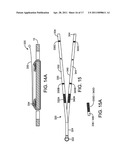 METHODS OF ACHIEVING INCREASED FLUID DISTRIBUTION WITH AND PATIENT KITS FOR RESUSCITATION SYSTEMS diagram and image