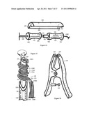 Internal and external disc shunts alleviate back pain diagram and image