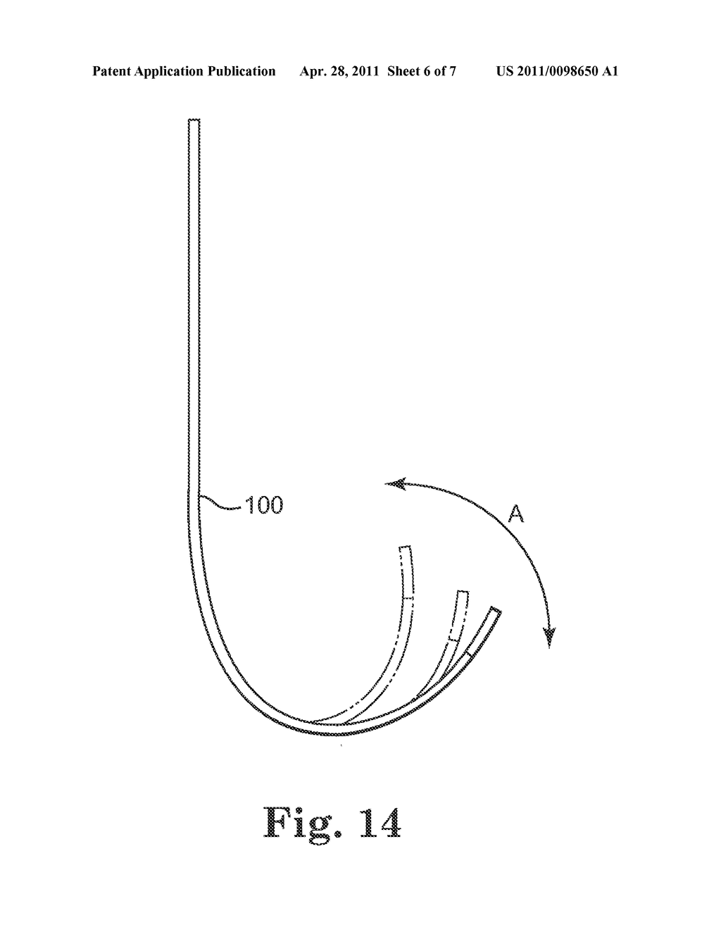 METHOD FOR MANIPULATING AN ADJUSTABLE SHAPE GUIDE CATHETER - diagram, schematic, and image 07