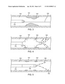 Over-The-WIre Balloon Catheter for Efficient Targeted Cell Delivery diagram and image