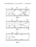 Over-The-WIre Balloon Catheter for Efficient Targeted Cell Delivery diagram and image