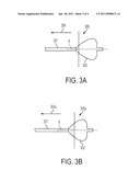 BALLOON CATHETER AND METHODS FOR PERICARDIOCENTESIS AND PERCUTANEOUS PERICARDIOTOMY diagram and image