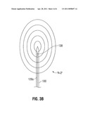 System and Method for Monitoring Ablation Size diagram and image