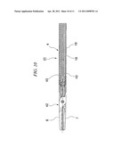 HIGH-FREQUENCY TREATMENT INSTRUMENT diagram and image