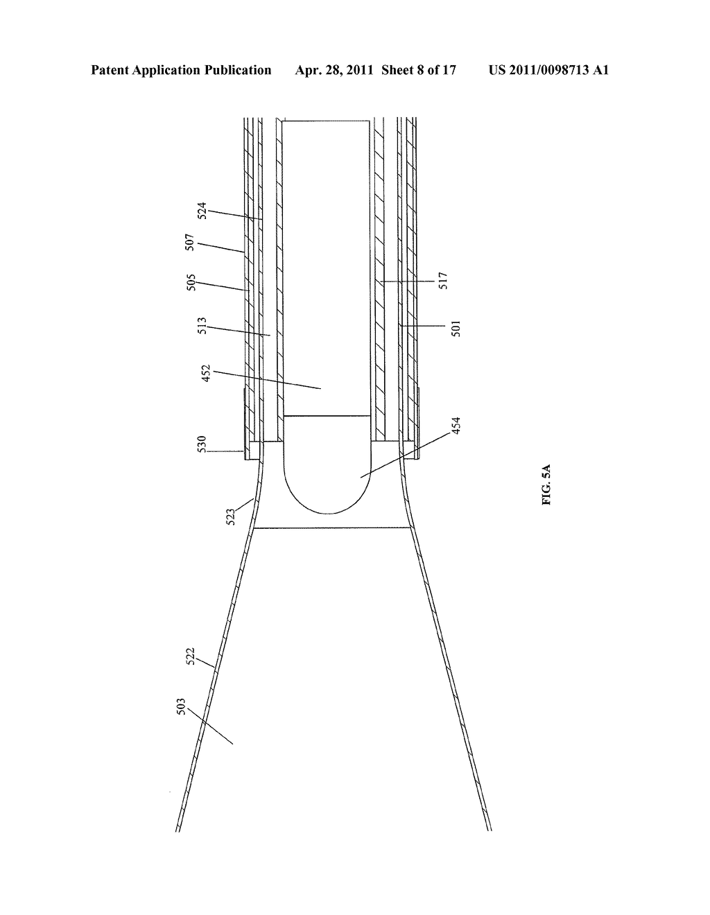 Systems and Methods for Internal Bone Fixation - diagram, schematic, and image 09