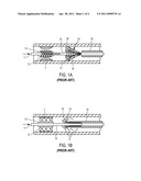 INTERVENTIONAL CATHETER FOR RETROGRADE USE HAVING EMBOLIC PROTECTION CAPABILITY AND METHODS OF USE diagram and image