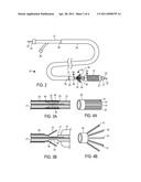 INTERVENTIONAL CATHETER FOR RETROGRADE USE HAVING EMBOLIC PROTECTION CAPABILITY AND METHODS OF USE diagram and image