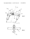 Method For Stabilizing The Spine diagram and image