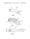 Method For Stabilizing The Spine diagram and image