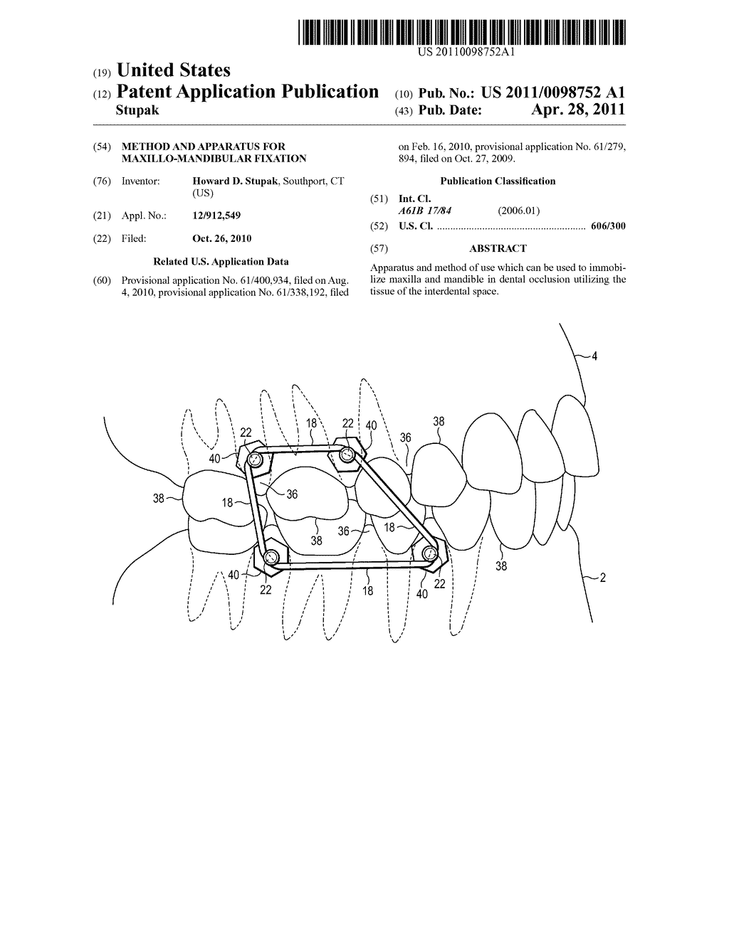 METHOD AND APPARATUS FOR MAXILLO-MANDIBULAR FIXATION - diagram, schematic, and image 01