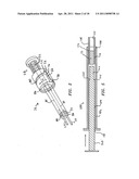 Implant manipulation and storage tools diagram and image