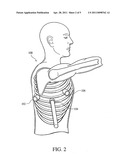 ELECTRICAL STIMULATION OF THE SYMPATHETIC NERVE CHAIN diagram and image