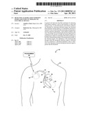 DETECTING LEAD RELATED CONDITION DURING DELIVERY OF THERAPEUTIC ELECTRICAL SIGNALS diagram and image