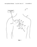 DETECTING LEAD RELATED CONDITION DURING DELIVERY OF THERAPEUTIC ELECTRICAL SIGNALS diagram and image