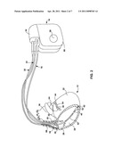 DETECTING LEAD RELATED CONDITION DURING DELIVERY OF THERAPEUTIC ELECTRICAL SIGNALS diagram and image