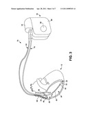 DETECTING LEAD RELATED CONDITION DURING DELIVERY OF THERAPEUTIC ELECTRICAL SIGNALS diagram and image