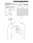 NON-SUSTAINED TACHYARRHYTHMIA ANALYSIS TO IDENTIFY LEAD RELATED CONDITION diagram and image