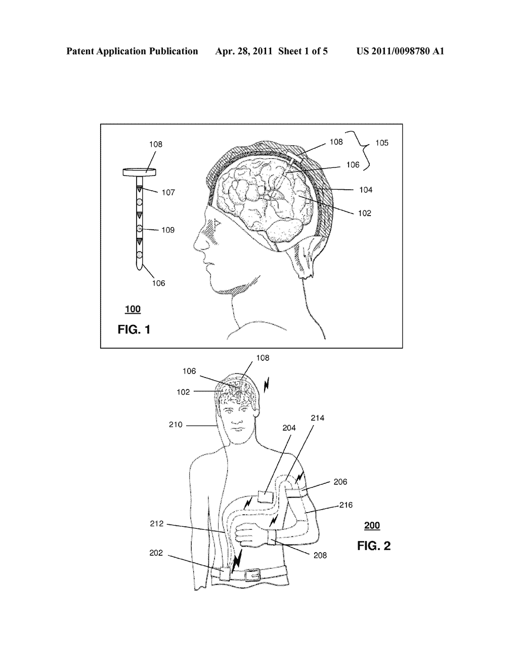 APPARATUS FOR MANAGING A NEUROLOGICAL DISORDER - diagram, schematic, and image 02