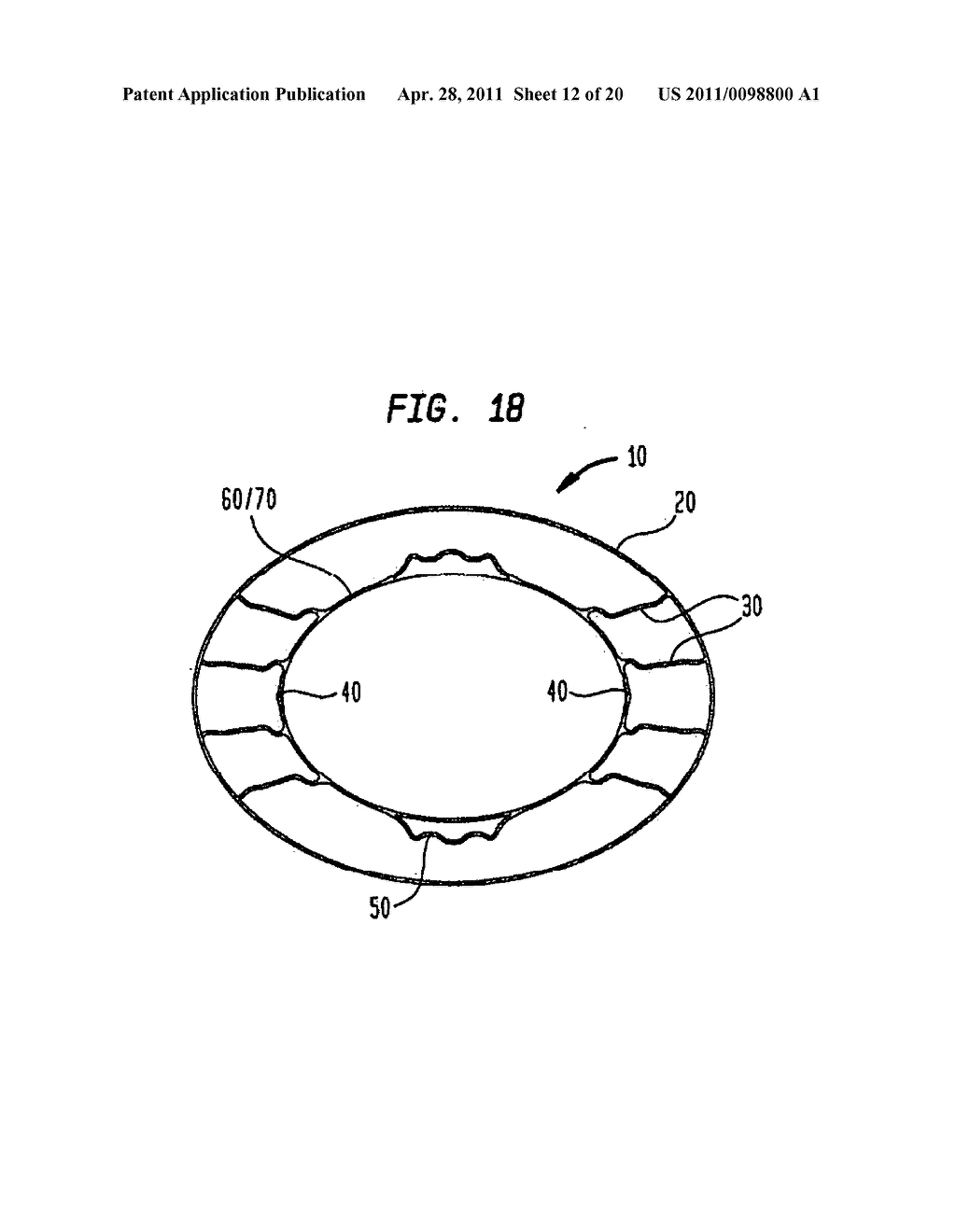 AXIALLY ANCHORING COLLAPSIBLE AND RE-EXPANDABLE PROSTHETIC HEART VALVES FOR VARIOUS DISEASE STATES - diagram, schematic, and image 13