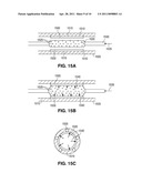 Controlled Degradation Of Stents diagram and image