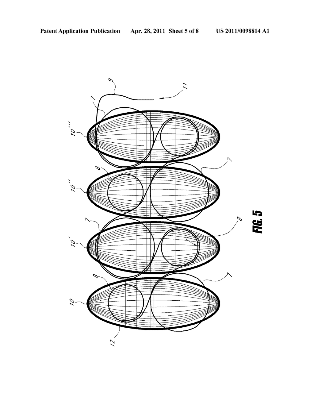 MEDICAL IMPLANT - diagram, schematic, and image 06