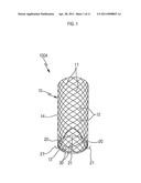 STENT FOR PROSTATIC URETHRA EXPANSION diagram and image