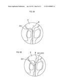 STENT FOR PROSTATIC URETHRA EXPANSION diagram and image