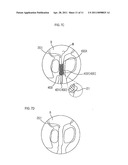 STENT FOR PROSTATIC URETHRA EXPANSION diagram and image