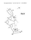 AUTOMATIC PROSTHESIS FOR ABOVE-KNEE AMPUTEES diagram and image