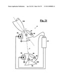 AUTOMATIC PROSTHESIS FOR ABOVE-KNEE AMPUTEES diagram and image