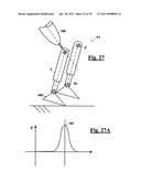 AUTOMATIC PROSTHESIS FOR ABOVE-KNEE AMPUTEES diagram and image