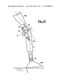 AUTOMATIC PROSTHESIS FOR ABOVE-KNEE AMPUTEES diagram and image