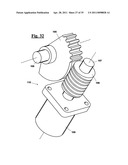 AUTOMATIC PROSTHESIS FOR ABOVE-KNEE AMPUTEES diagram and image