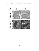 ANIMAL MODEL FOR CIGARETTE-SMOKE-INDUCED ATHEROSCLEROSIS AND RELATED METHODS diagram and image