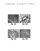 ANTIBODIES AGAINST CD38 FOR TREATMENT OF MULTIPLE MYELOMA diagram and image