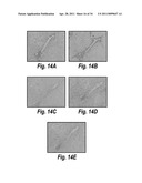 ANTIBODIES AGAINST CD38 FOR TREATMENT OF MULTIPLE MYELOMA diagram and image