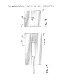 CATHETER BALLOON DRUG ADHERENCE TECHNIQUES AND METHODS diagram and image