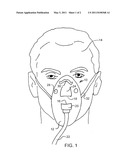 Face mask for endoscopy diagram and image