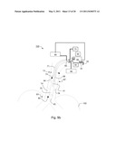 METHOD OF DETECTING ENDOTRACHEAL TUBE MISPLACEMENT diagram and image