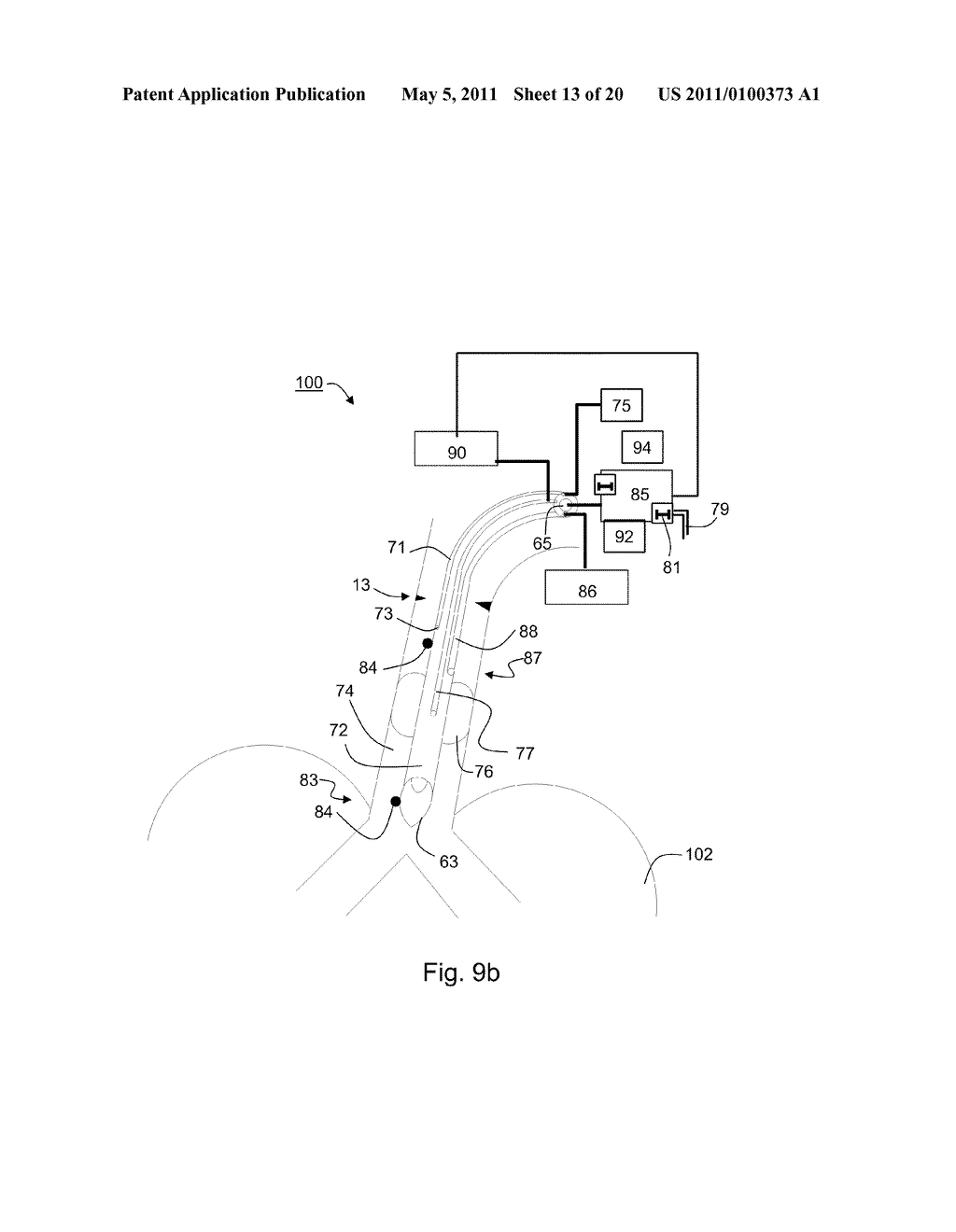 METHOD OF DETECTING ENDOTRACHEAL TUBE MISPLACEMENT - diagram, schematic, and image 14