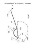 Method and Apparatus for Producing Stationary Intense Wave Fields of Arbitrary Shape diagram and image