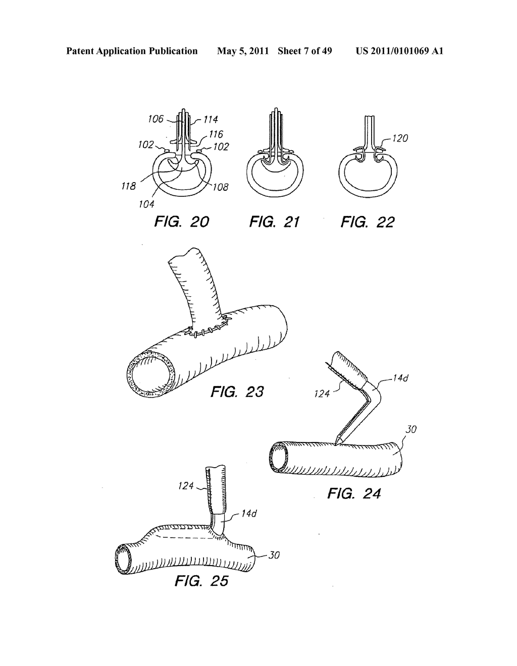 Surgical Stapler with Direct Sled to Staple Contact - diagram, schematic, and image 08