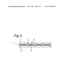 COUPLING CONSTRUCTION FOR HIGH-PRESSURE PIPE diagram and image