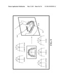 THREE-DIMENSIONAL DIGITAL MAGNIFIER OPERATION SUPPORTING SYSTEM diagram and image