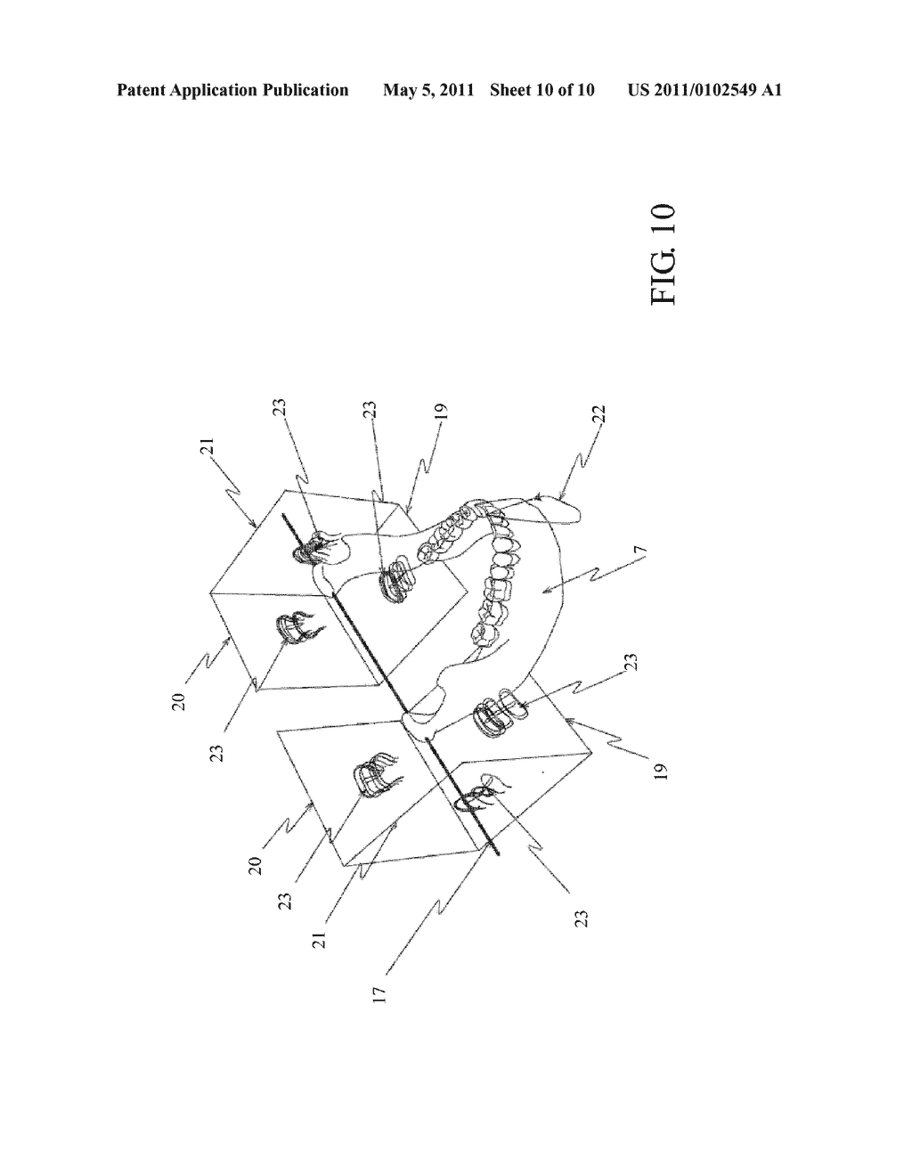 THREE-DIMENSIONAL DIGITAL MAGNIFIER OPERATION SUPPORTING SYSTEM - diagram, schematic, and image 11