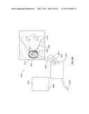 ELECTRONIC EARPLUG diagram and image